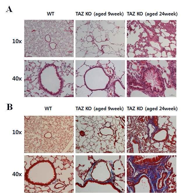 WWTR1 knockout mouse 폐조직에서의 심각한 염증반응 및 폐조직손상