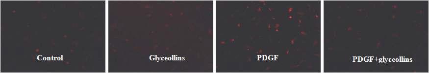 Effects of glyceollins (0.3 μg/mL) on PDGF-stimulated ROS production. Magnification x100.