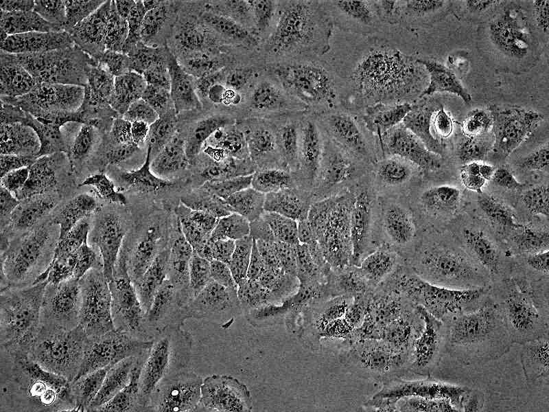 human keratinocyte (HaCaT) cells