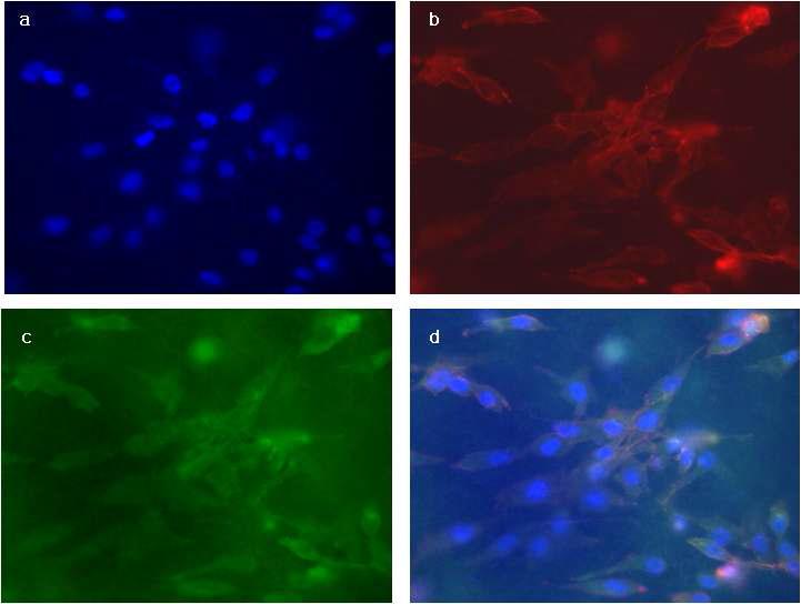 PLCL/MC 지지체에 세포 부착성 실험 결과; a) Nuclei: Hoechest 33258, b) Actin flaments: Rhodamine, c) Vinculin protein: Alexa Fluoro 488, d) Overlay (x400)