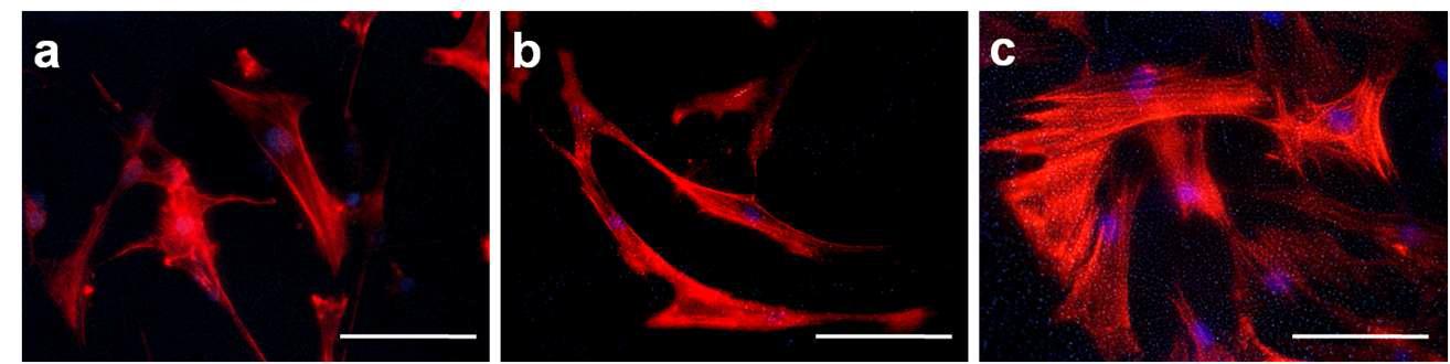 Fluorescent staining (72 hrs); a. PLCL, b. AAc-PLCL, c.Gelatin-AAc-PLCL (scale bar: 50 µm)