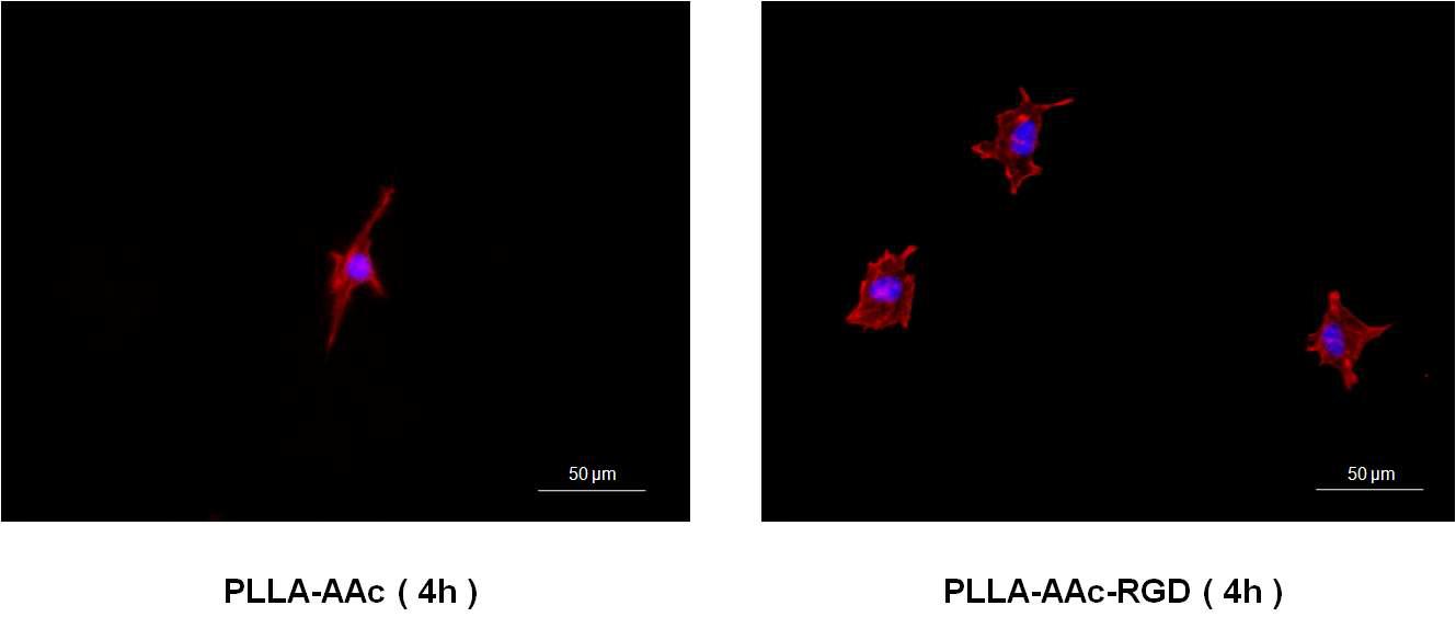 RGD immobilized AAc-PLLA 세포 지지체의 MC3T3-E1 cell염색 결과