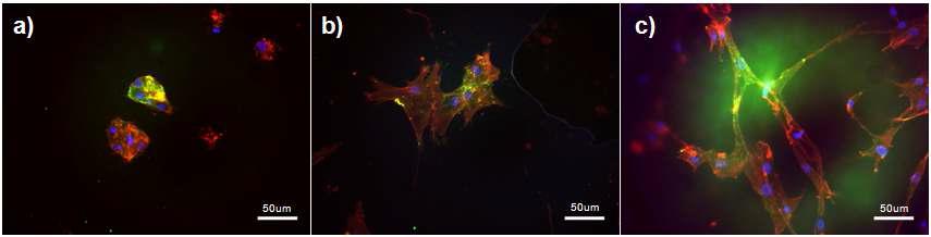 형광현미경으로 관찰한 성체줄기세포의 흡착 형태. a) PLCL, b) PLCL-AAc (3 wt% AAc), c) PLCL-AAc (5 wt% AAc)