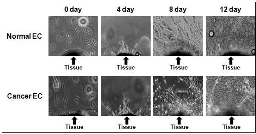 Sprouting endothelial cells from a normal or cancer tissue