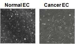 Isolated normal and cancer endothelial cells