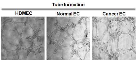 Tube formation of normal and cancer endothelial cells