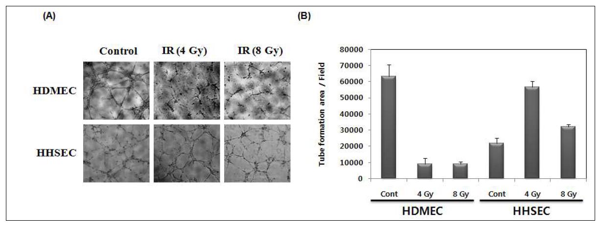 Effect of ionizing radiation on tube formation of HDMEC and HHSEC.