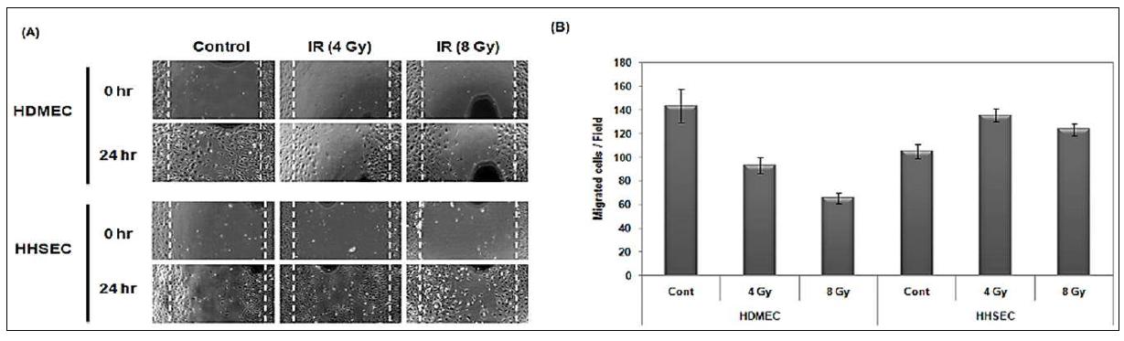 Effect of ionizing radiation on the migration of HDMEC and HHSEC.