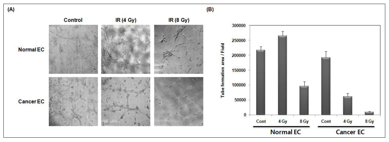 Effect of ionizing radiation on tube formation of normal and cancer endothelial cells.