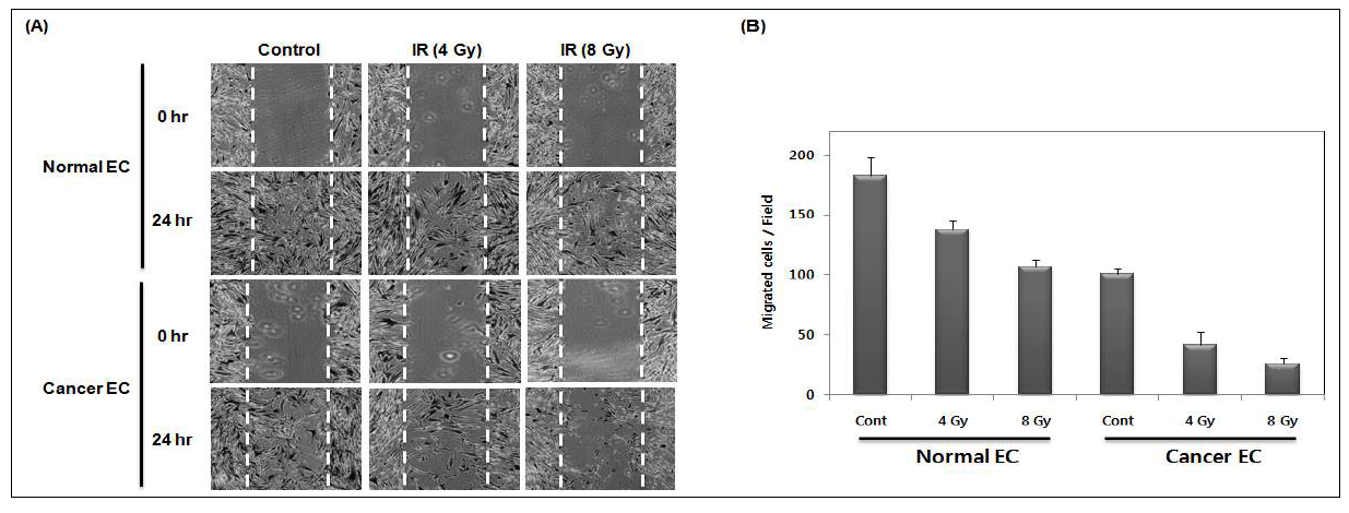 Effect of ionizing radiation on the migration of isolated normal and cancer endothelial cells.