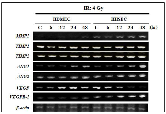 Effect of ionizing radiation on angiogenesis-related factor expression in HDMEC and HHSEC.