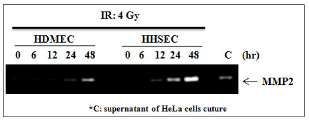 Effect of ionizing radiation on the enzyme activity of MMP2 in HDMEC and HHSEC.