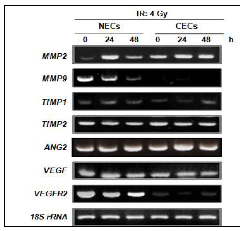 Effect of ionizing radiation on angiogenesis-related factor expression.