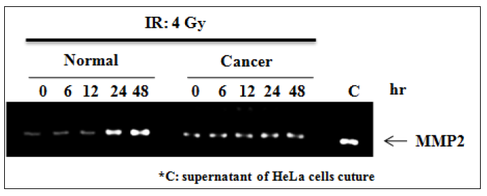 Effect of ionizing radiation on the enzyme activity of MMP2 in normal and cancer endothelial cells