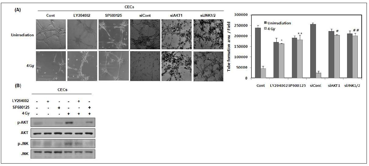 AKT and JNK activation is necessary for the angiostatin-mediated suppression of tube formation of CECs