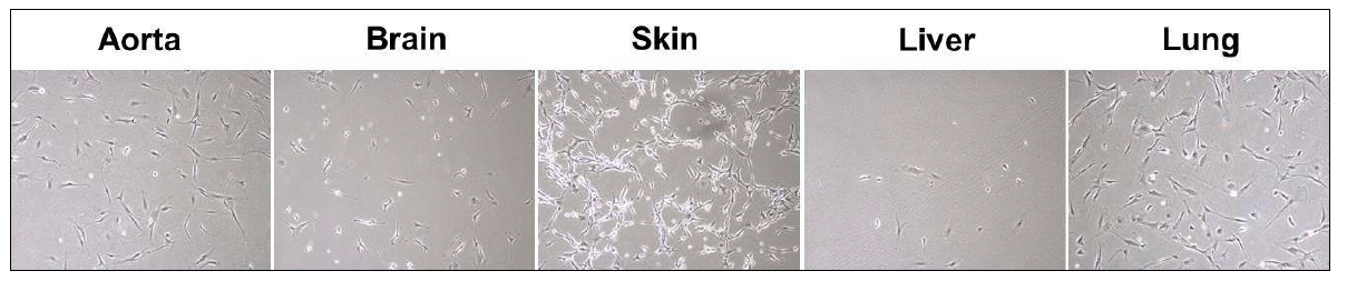 Endothelial cells Isolated from various mouse tissues.