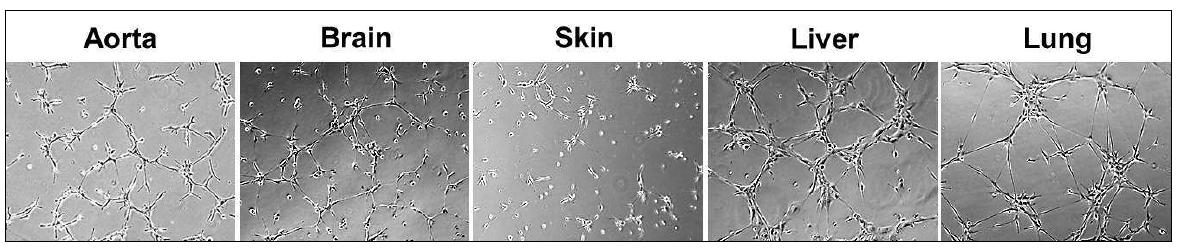 Tube formation of endothelial cells isolated from various mouse tissues.