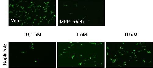 ropinirole을 처리한 primary neuron에서 세포보호효과(면역염색 분석)