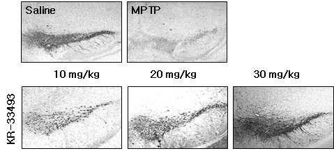 KR-33493 처리한 파킨슨병 동물모델에서 신경세포 보호효과(조직염색)