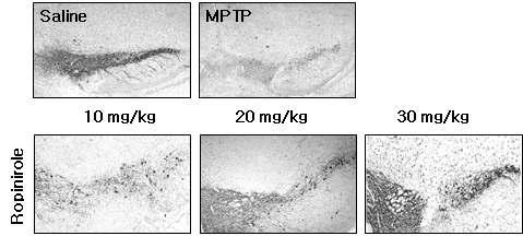 Ropinirole 처리한 파킨슨병 동물모델에서 신경세포 보호효과(조직염색)
