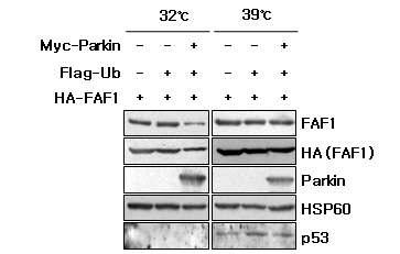 Parkin에 의한 FAF1의 ubiquitin 의존적 분해