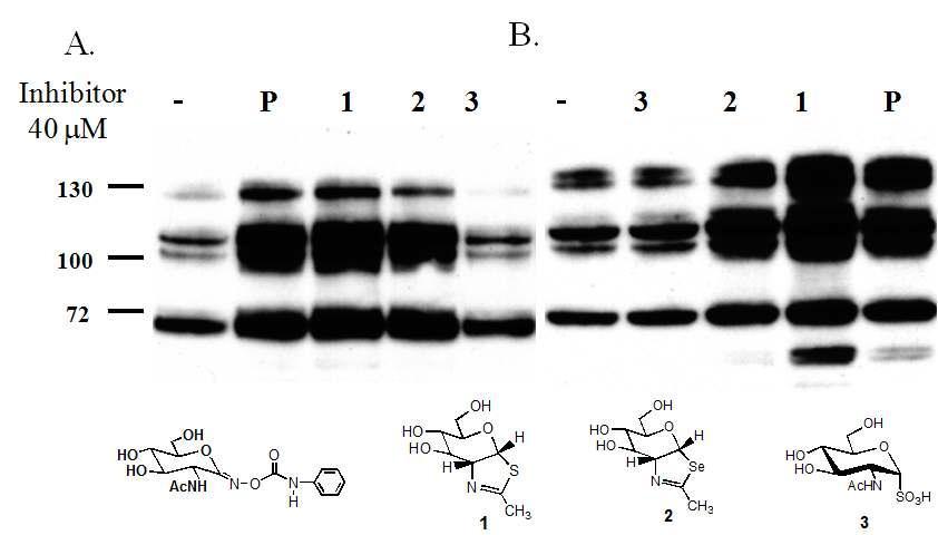 Western blot 분석