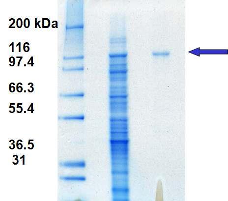 SDS-PAGE analysis of purified O-GlcNAcase (MGEA5).