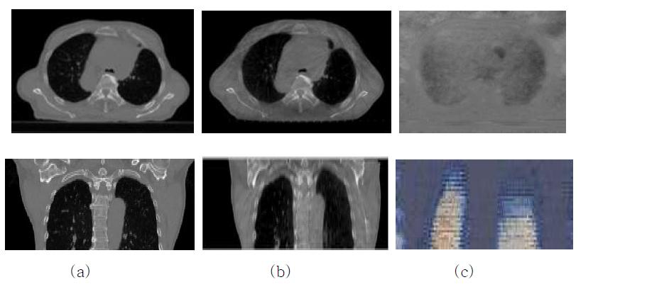 치료계획용 CT, kV CBCT, 변형필드