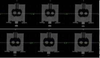 폐 변형 모델의 호흡 주기에 따른 4D CT 영상의 coronal view