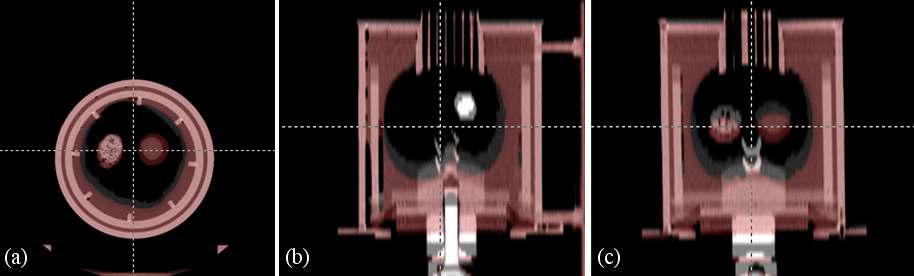 Peak exhale 상태와 peak inhale 상태의 rigid body registration 결과 (a) axial view (b) sagittal view (c) coronal view