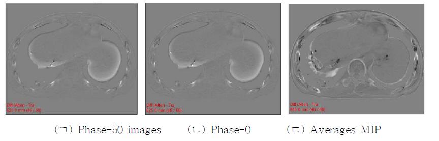 Differences after deformable registration