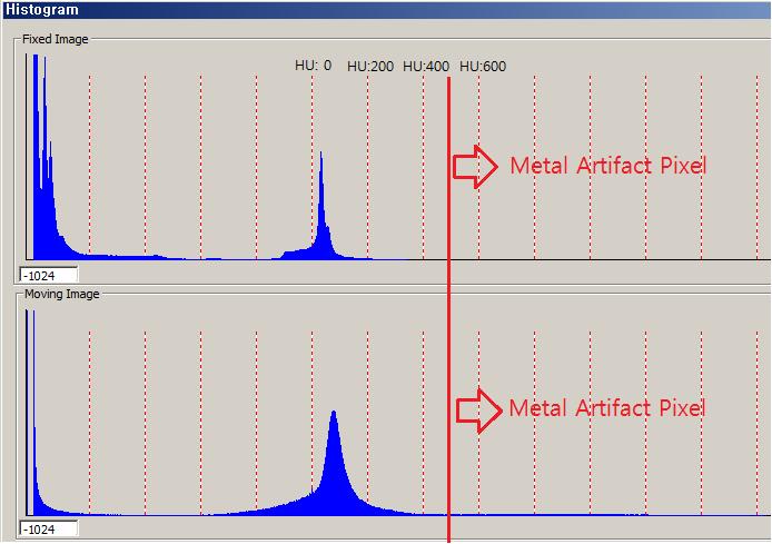 두경부 영역의 Fan beam CT (그래프 상단)와 Cone beam CT(그래프 하단)의 Histogram 비교. HU값이 500 이상인 영역의 픽셀들이 metal artifact에 의한 영역으로서 특히 Cone beam CT에서 상당부분을 차지하고 있음.