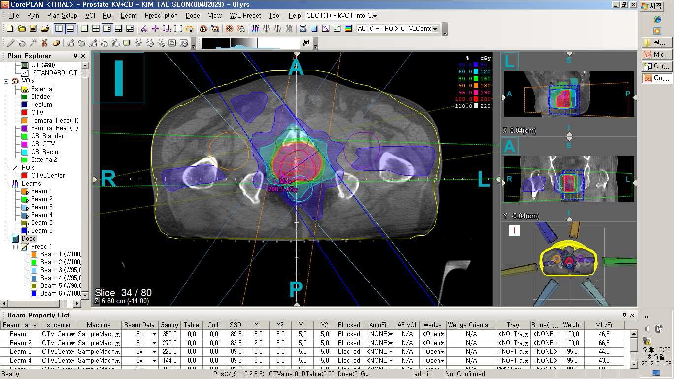 Aligned kVCT plan의 치료 계획 인자들을 적용한 CBCT plan의 형성 및 치료 계획 평가