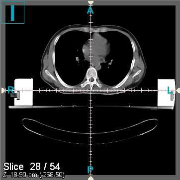 DICOM 3.0 영상 표시: 화면에 나타내는 항목으로 DICOM 영상, 현재 Slice 번호, 전체 Slice 개수, Z축 좌표, 상하좌우 표시 등을 구현