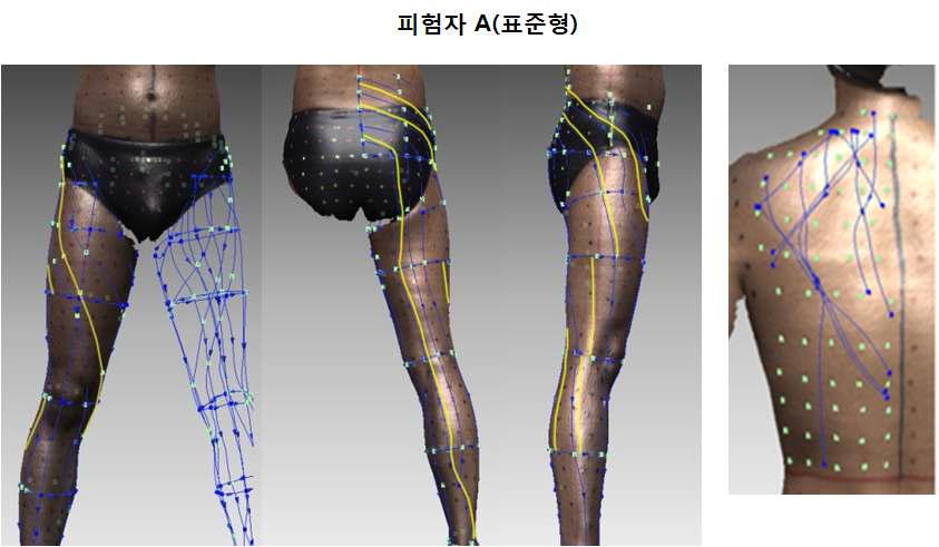 표준형 피험자 A의 피부 무변형선