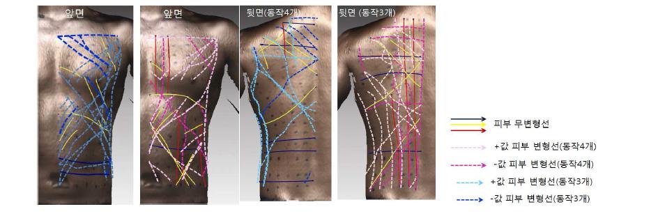 상체 피부 변형선 중합도