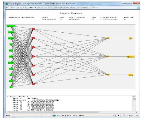 Neural Netwrok를 이용한 진단 결과 화면