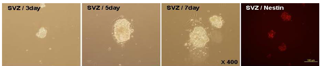 mouse SVZ 세포의 광학현미경사진. 배양3, 5, 7일 후의 Neurosphere의 형태이며 Neural Progenitor cell Marker 인 Nestin으로 염색하여 NSCs 을 확인.