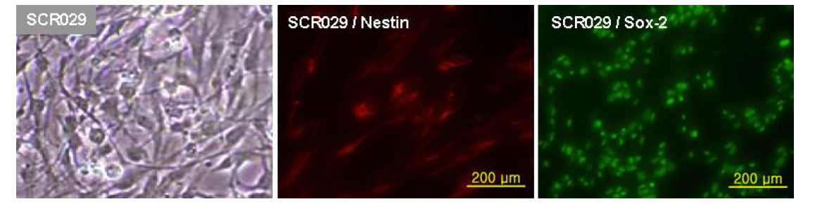 Mouse Cortical NSC, SCR029의 현미경사진