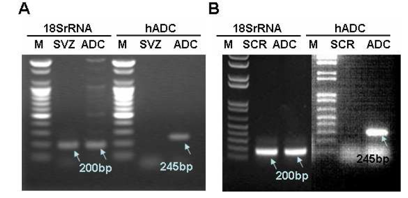 human ADC 발현을 확인을 위한 RT-PCR.