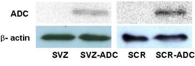 human ADC 발현을 확인을 위한 western blot.