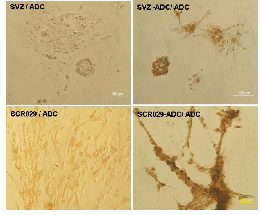 human ADC 발현을 확인을 위한 mouse SVZ 세포와 SCR029의 광학현미경 사진