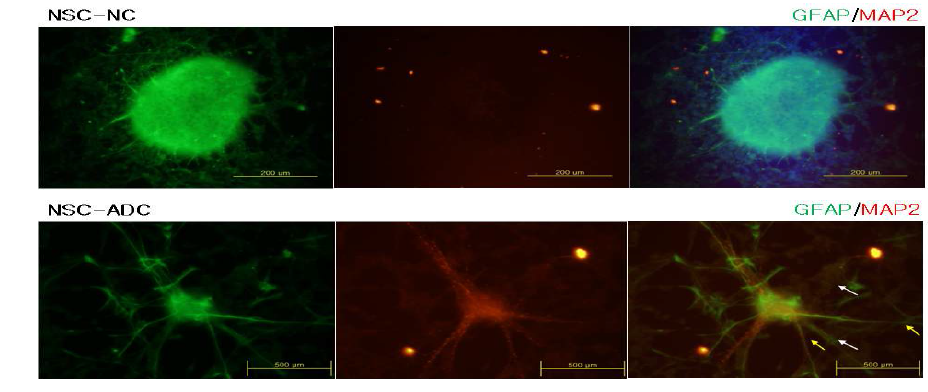 ADC overexpressed NS cells can differentiate to both glia and neuron.