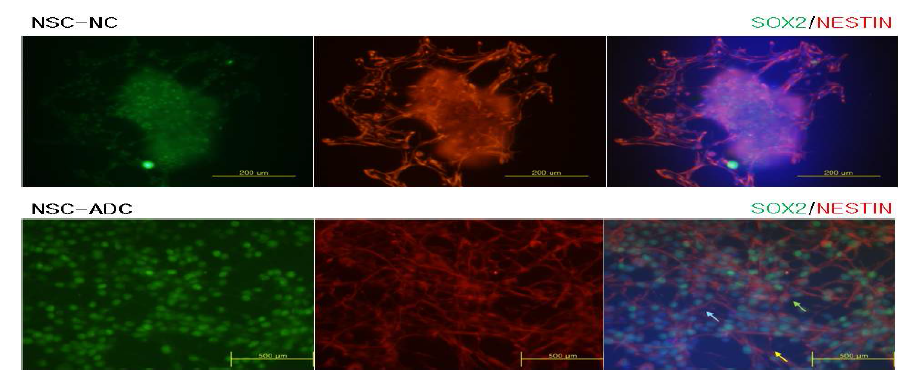 most of ADC overexpressed NS cells and normal cells differentiate with potential like neural stem cell