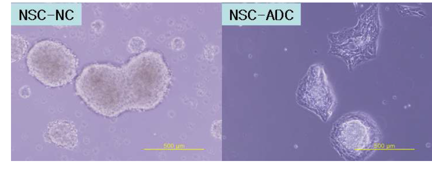 ADC overexpressed NS cells are attached and differentiate earlier than normal NS cells