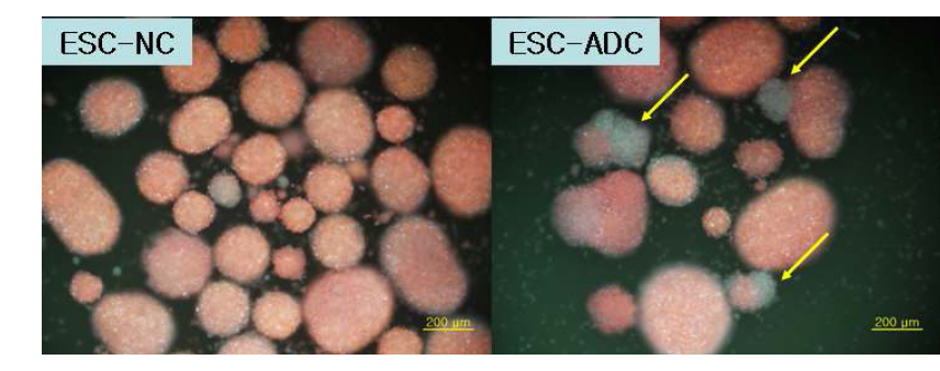 ADC overexpressed NS cells and normal NS cells are stained with Hoechst-PI 24hrs after H2O2 injury.