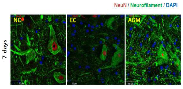 Immunostaining (NeuN. Neurofilament)