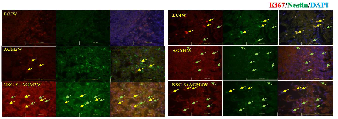 1)Agmatine promoted differentiation of neural stem cell into early neuron.