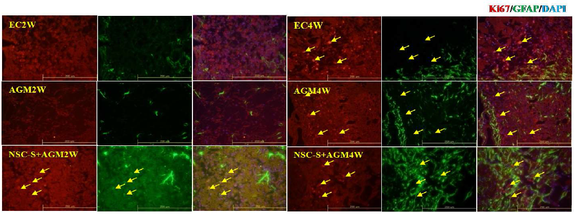 2) Agmatine activated glia scar formation in ischemic region.