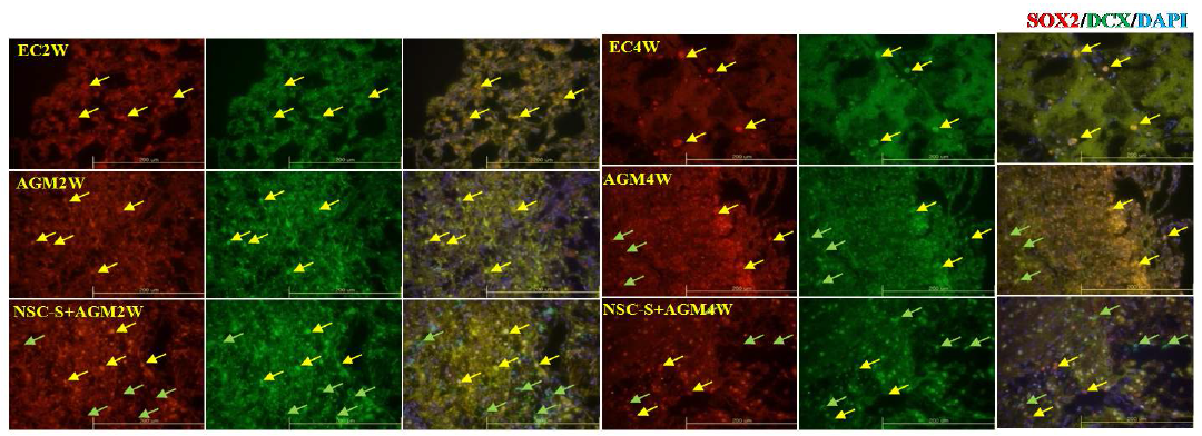 3) Agmatine enhances neuroblast migration and neurogenesis.